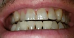 20200718 073157