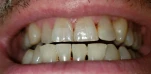 20200718 073524