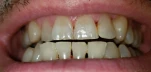 20200718 073037