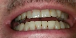 20200718 073003