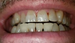 20200718 073222